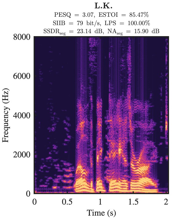L.K. enhanced speech spectrogram