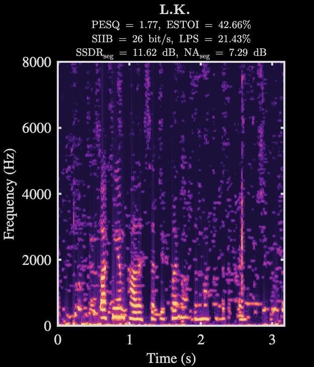 L.K. enhanced speech spectrogram