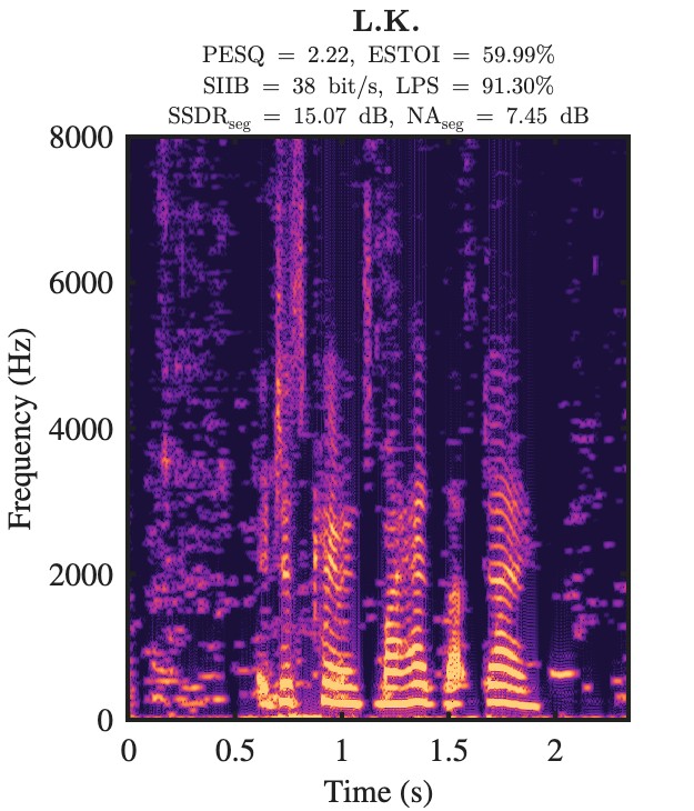 L.K. enhanced speech spectrogram