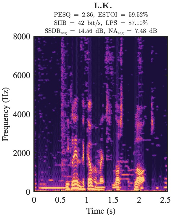 L.K. enhanced speech spectrogram