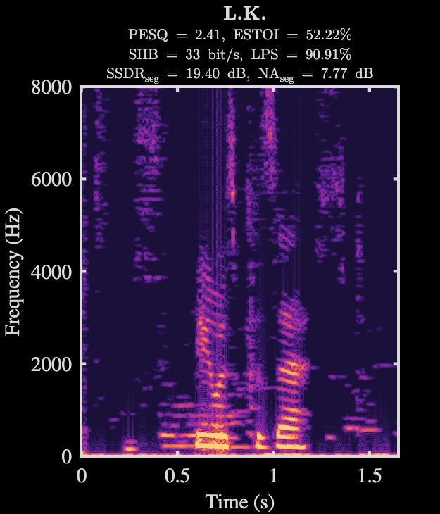 L.K. enhanced speech spectrogram