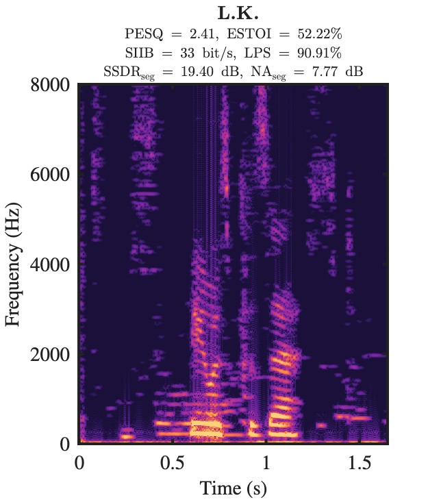 L.K. enhanced speech spectrogram