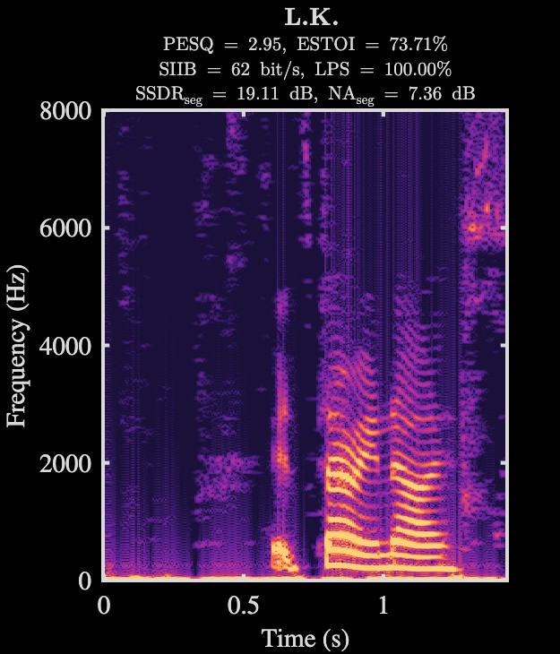 L.K. enhanced speech spectrogram