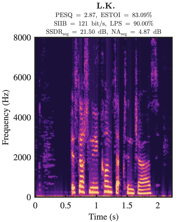 L.K. enhanced speech spectrogram