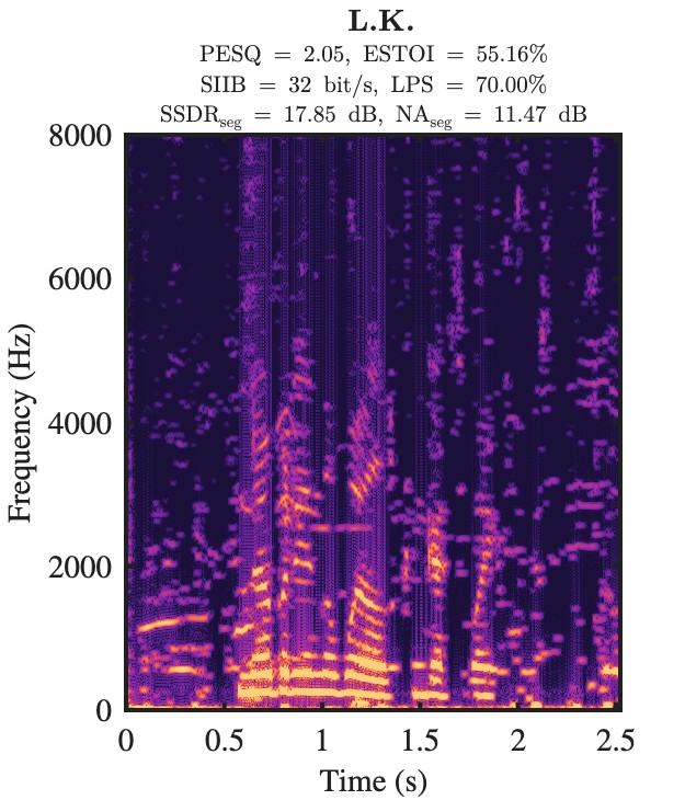 L.K. enhanced speech spectrogram