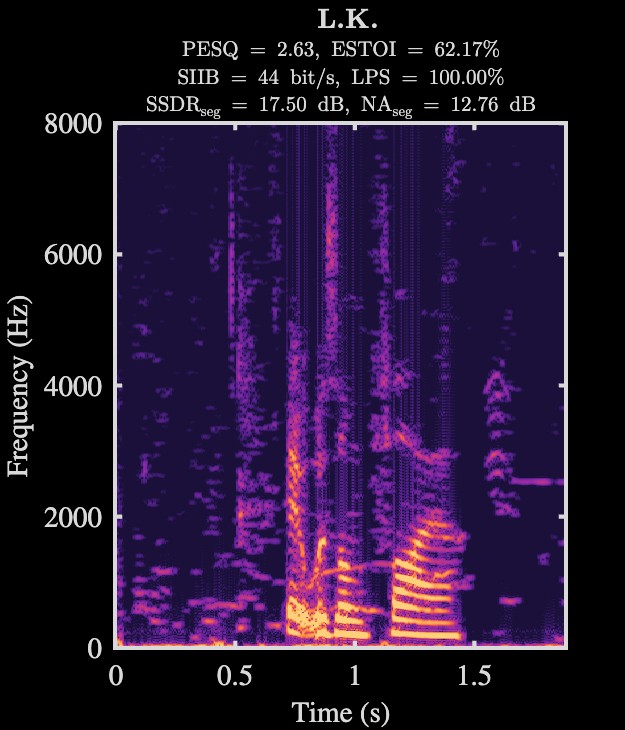 L.K. enhanced speech spectrogram