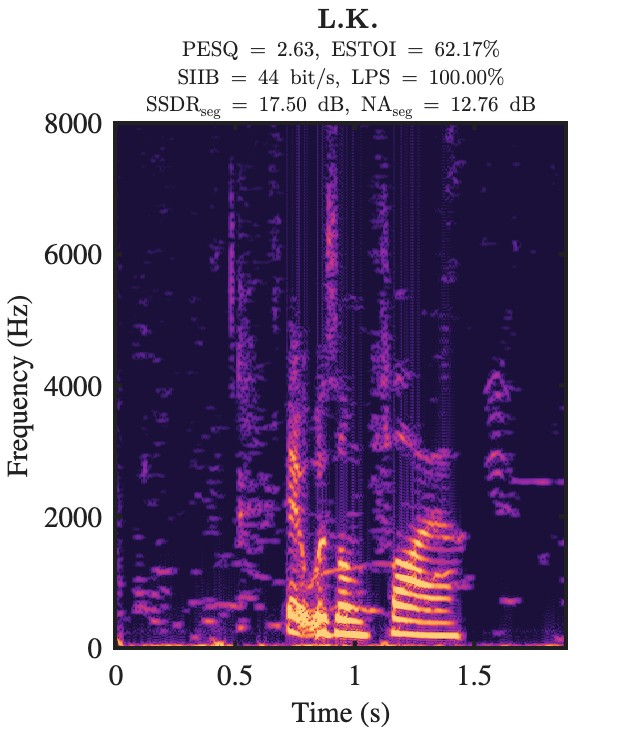 L.K. enhanced speech spectrogram